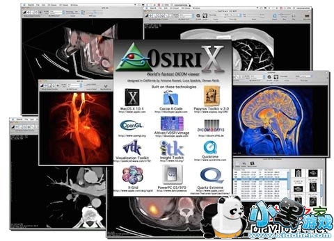 OsiriX