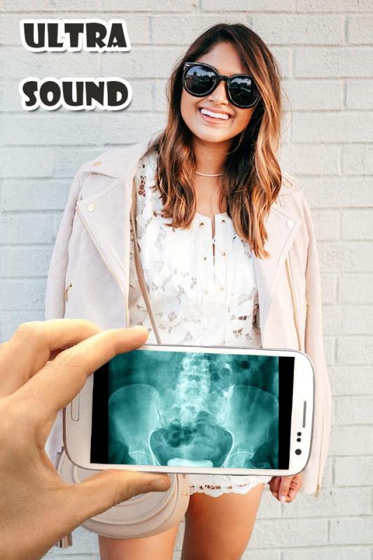 UltraSoundXrayScannerPrank