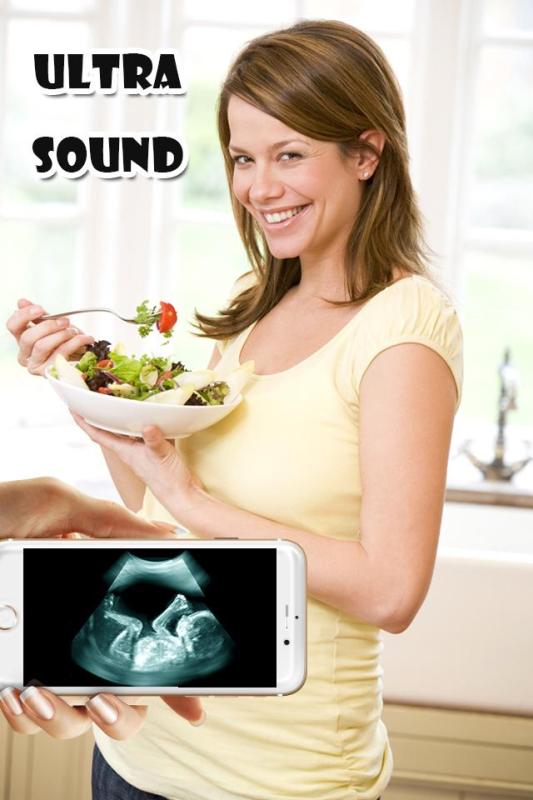 UltraSoundXrayScannerPrank